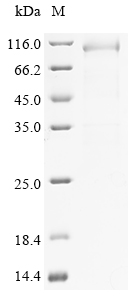 SDS-PAGE