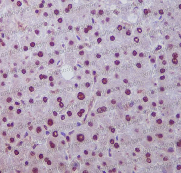 Валидация AntibodySystem RHG80301