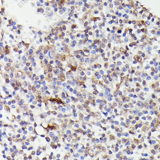 Иммуногистохимия, CDC23, ткань миндалин человека