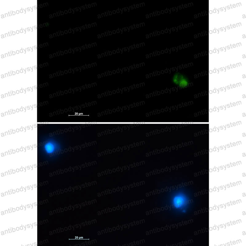 Валидация IF - AntibodySystem RHD38501