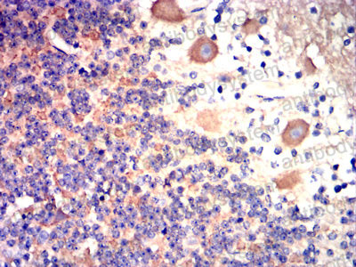 Валидация AntibodySystem RHD08207