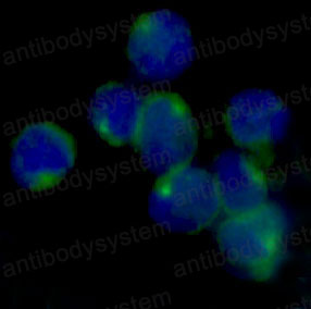 Валидация IF - AntibodySystem RHD77701