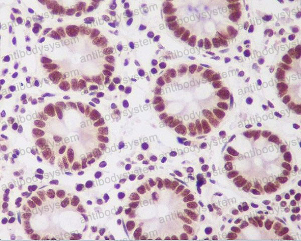 Валидация AntibodySystem RHN59301