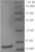 SDS-PAGE