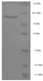 SDS-PAGE