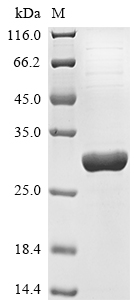 SDS-PAGE
