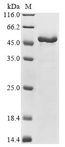 SDS-PAGE