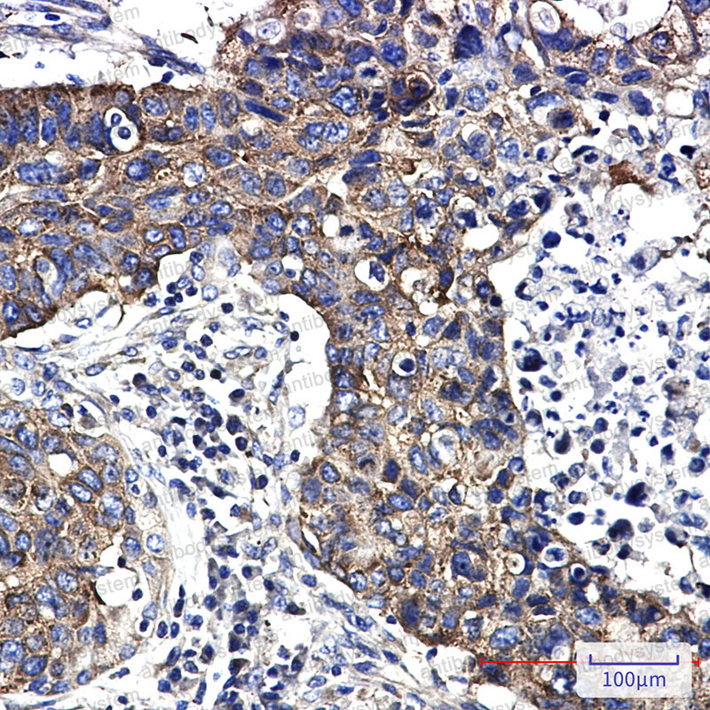 Валидация AntibodySystem RHG10301