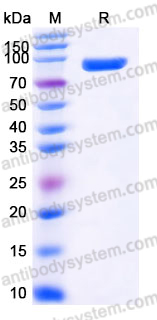 EHJ63802, SDS-PAGE