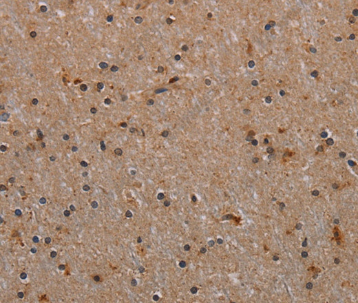 Иммуногистохимия, p70 S6 kinase beta, ткань мозга человека