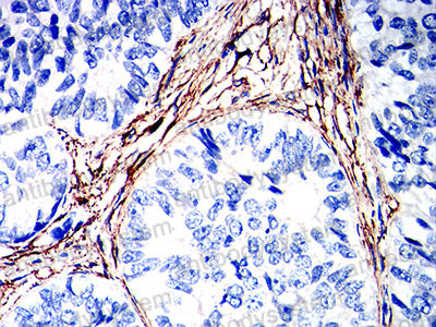 Валидация AntibodySystem RHH81905