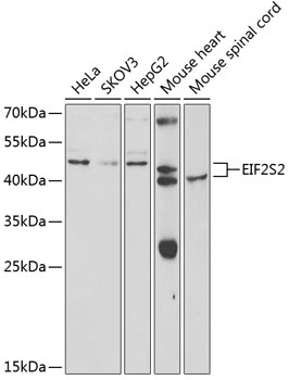 Валидация Elabscience E-AB-92687
