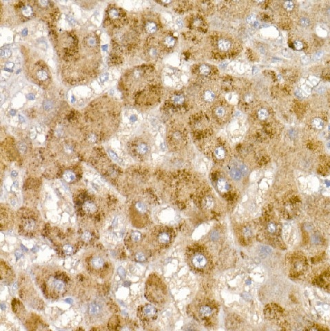 Иммуногистохимия, Glycerol kinase, ткань печени человека
