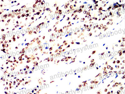 Валидация AntibodySystem RHD14102 (1349)