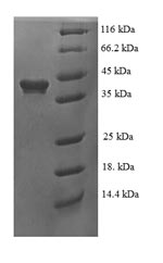 SDS-PAGE