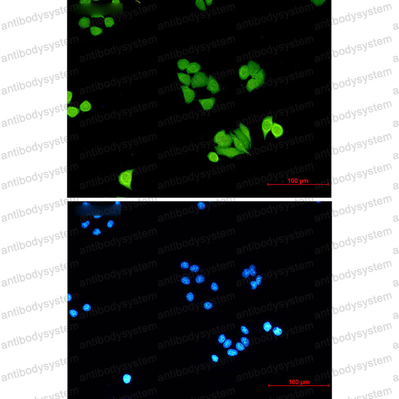 Валидация IF - AntibodySystem RHE97402