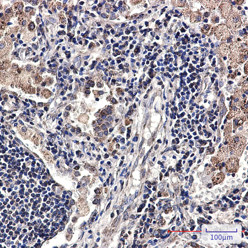 Валидация AntibodySystem RHK20903
