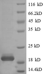 SDS-PAGE