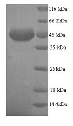 SDS-PAGE