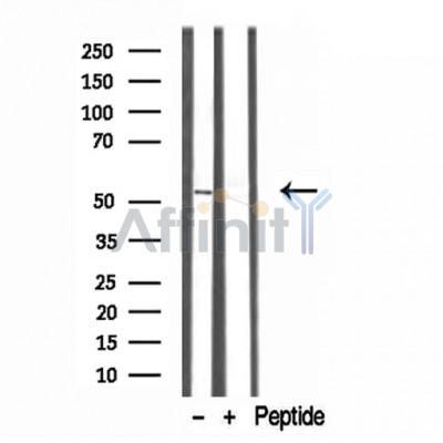 Валидация Affinity DF12177 - 6394