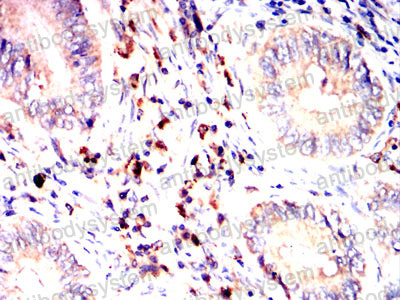 Валидация AntibodySystem RHD74903 (1794)