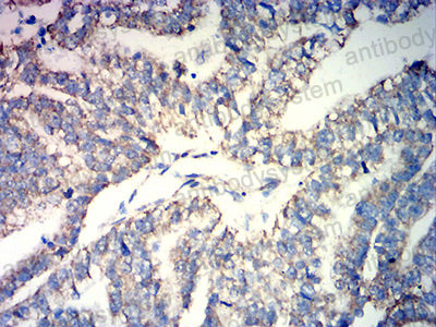 Валидация AntibodySystem RHD67602