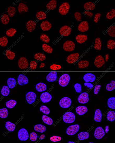 Иммунофлуоресценция, Histone H2AX, клетки HeLa