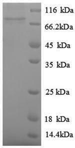 SDS-PAGE