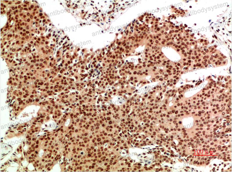 Валидация AntibodySystem RHG48105