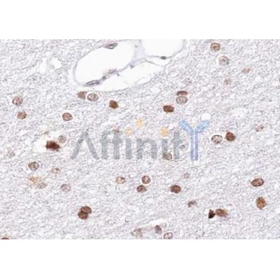 Валидация Affinity AF6288 - 3549