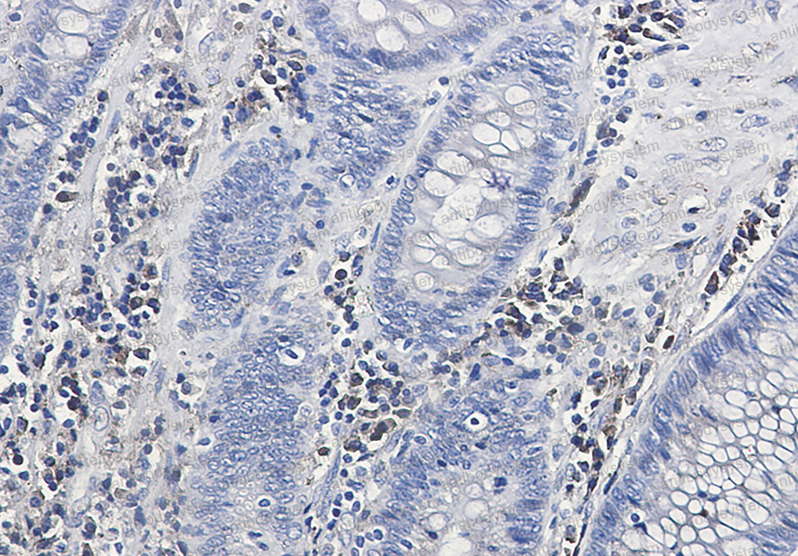 Валидация AntibodySystem RHA80201