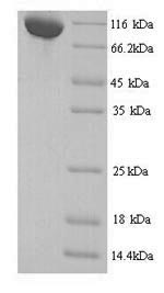 SDS-PAGE