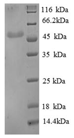 SDS-PAGE