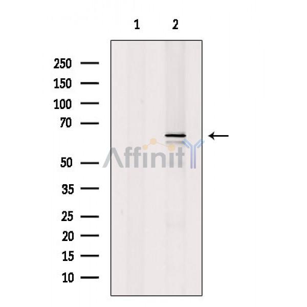 Валидация Affinity DF6540 - 17972