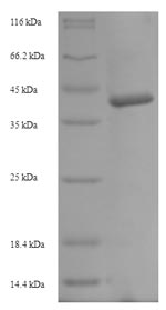 SDS-PAGE