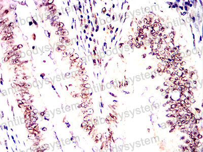 Валидация AntibodySystem RHE73902 (2296)