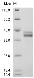 SDS-PAGE