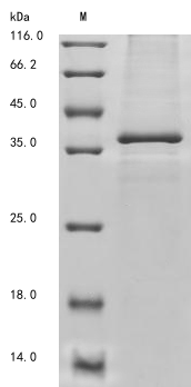 SDS-PAGE