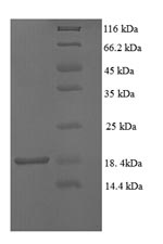 SDS-PAGE
