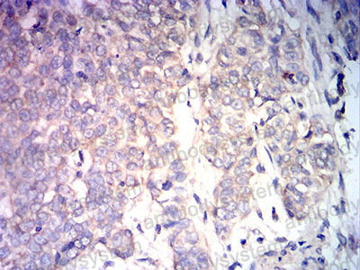 Валидация AntibodySystem RHG13209