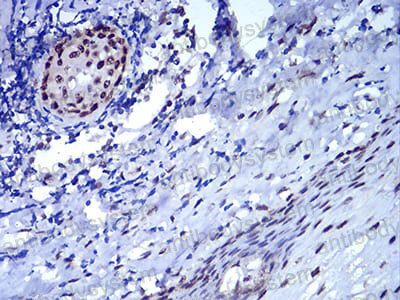 Валидация AntibodySystem RHE45604