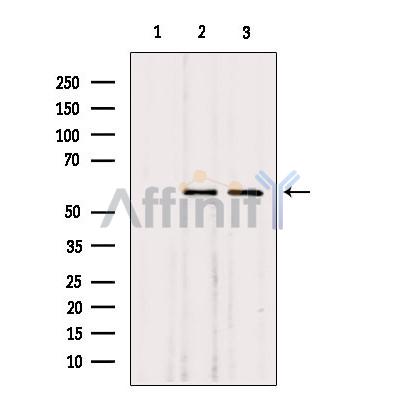 Валидация Affinity DF6358 - 17708