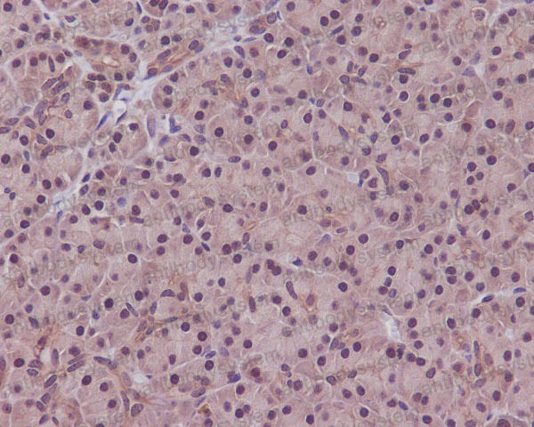 Валидация AntibodySystem RHF48301