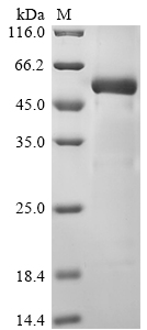 SDS-PAGE