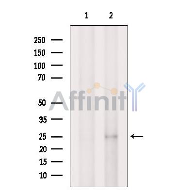 Валидация Affinity DF9237 - 21657