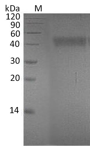 SDS-PAGE