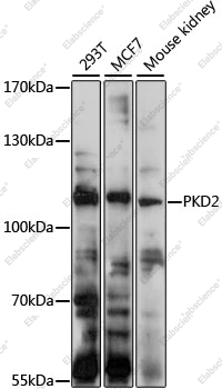 Вестерн-блоттинг, PKD2, различные клеточные линии