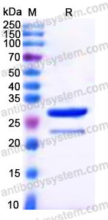 YHP08401, SDS-PAGE