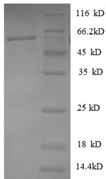 SDS-PAGE