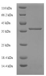 SDS-PAGE
